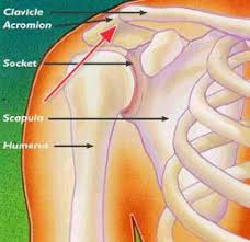 Check spelling or type a new query. Shoulder Separation Orthoinfo Aaos