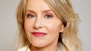 The £7,000 pain-free eyelift that takes 30 minutes and leaves your friends  wondering