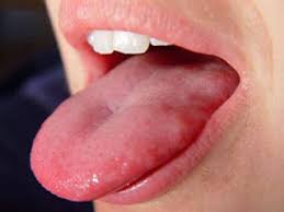 Maybe you would like to learn more about one of these? Ø§Ù‡Ù…ÙŠØ© Ù„ÙˆÙ† ÙˆØ­Ø¬Ù… ÙˆØ·Ø¨ÙŠØ¹Ø© Ø§Ù„Ø·Ø¨Ù‚Ø§Øª Ø¹Ù„Ù‰ Ø§Ù„Ù„Ø³Ø§Ù† ÙÙŠ Ø§Ù„ØªØ´Ø®ÙŠØµ ÙˆØ§Ù„Ø¹Ù„Ø§Ø¬ ÙÙŠ Ø§Ù„Ø·Ø¨ Ø§Ù„ØµÙŠÙ†ÙŠ Ø³ÙˆØ§Ù„ÙŠÙ