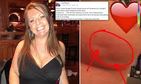 Ibc does not usually cause lumps to form in breast tissue. Breast Cancer Patient Lisa Royle S Facebook Photo Of Dimple On Breast Daily Mail Online