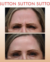 Sutton Dermatology + Aesthetics