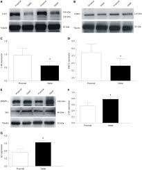 Different Distributions Of Interstitial Cells Of Cajal And