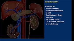 The Radiology Assistant Ct Contrast Injection And Protocols