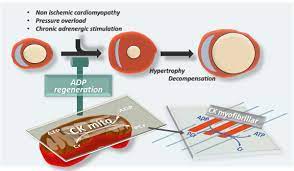 Mitochondrial Creatine Kinase Attenuates Pathologic Remodeling in Heart  Failure | Circulation Research