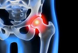 Epingle Sur Nouvelle Therapie Sante