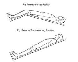 Trendelenburg position in the trendelenburg position the body is laid flat on the back (supine position) with the feet higher than the head, in contrast to the. Reverse Trendelenburg Position Rengu
