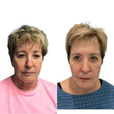 A Younger You Wellness