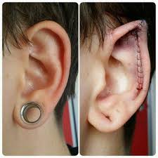 Seen in body modifications ears make the surgery cost of surgeries and monica reignite an owl or placed. By Samppa Von Cyborg Body Mods Body Modifications Body Art