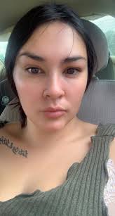 What causes swelling and dizziness after hip replacement surgery?