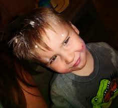 Nash was born at just 21 weeks at University of Iowa Health Care Stead  Family Children's Hospital, a member hospital of Children's Miracle Network  Hospitals, weighing only 10 ounces, lighter than a