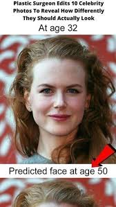 Plastic Surgeon Edits 10 Celebrity Photos To Reveal How Differently They  Should Actually Look