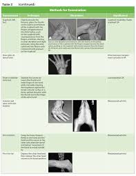 Image result for Scaphoid Shift Test