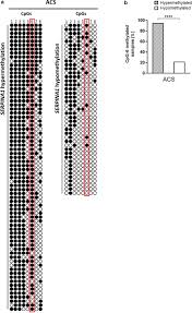 Know the symptoms, causes and treatment. Methylation Of Serpina1 Gene Promoter May Predict Chronic Obstructive Pulmonary Disease In Patients Affected By Acute Coronary Syndrome Springerlink
