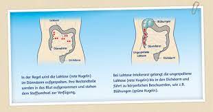 Minusl Homepage Laktoseintoleranz Was Passiert Im Darm Laktoseintoleranz Darm