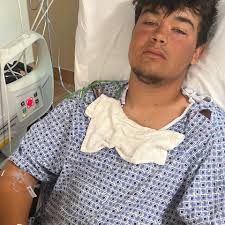 Fundraiser for James Harrison by Milan Brigham : Help James with medical  expenses & his prosthetic