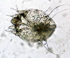 Image result for Sarcoptes scabiei