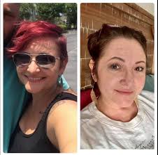 Psoriasis Awareness Health Fair in North Carolina