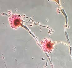Aspergillus fumigatus is a species of fungus in the genus aspergillus, and is one of the most common aspergillus species to cause disease in individuals with an immunodeficiency. Costs And Outcomes Associated With Invasive Aspergillosis Infections Infectious Disease Advisor