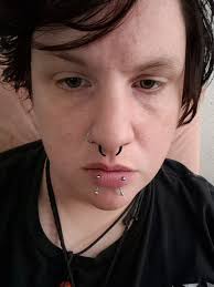 Is a painless bump inside the lip normal after a medusa piercing?