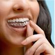 Dental Aligners product image
