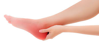 Learn more about haglund's deformity here. Retrocalcaneal Bursitis Caused By Haglund S Syndrome Orliman