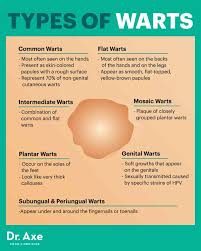 Maybe you would like to learn more about one of these? How To Get Rid Of Warts Naturally Wart Symptoms Causes Dr Axe