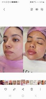 Safi Miran Rejuvenation Center Denver