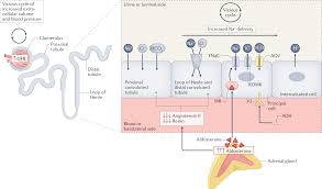 Image result for Hyperaldosteronism