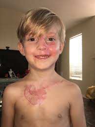 Fundraiser for Tiffany Hodson by Melissa Ethell : Help for Kyler and his  family