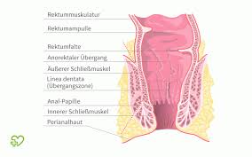 Martin wilhelmi erklärt, welche ursachen schmerzen am anus haben können. Analbeschwerden Afterbeschwerden Ursachen Und Therapie Onmeda De