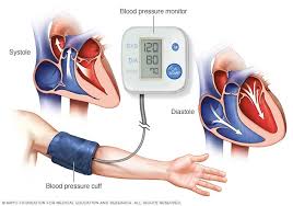 High Blood Pressure Hypertension Diagnosis And Treatment