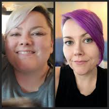 Who has been using GLP-1 meds? I'm wanting to try but have read so many  people lose tons of hair and I don't want that? Plus health issue like  pancreatitis and more.