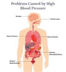 How To Lower Blood Pressure Naturally Or With Medications