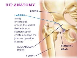Image result for Hip Labral Tear