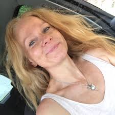 What food is best for dogs with skin allergies?