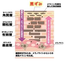 あそこが黒い人必見 まさか放置 デリケートゾーンの黒ずみを一発で消す裏技 女性のキレイを応援 ビューティーマガジン デリケートゾーン 裏技 黒ずみ