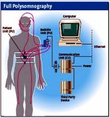 Image result for Polysomnogram