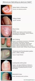 Nails Can Give Us A Great Feedback About Our Health Nail