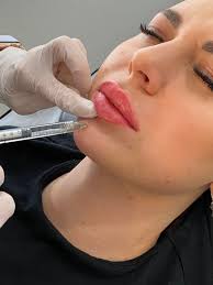 Let's welcome our new members! Bodyb Aesthetic