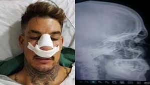 Jornada doble en el Gilberto Parada