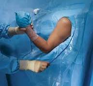 Beach Chair Shoulder Arthroscopy Drape II, Sterile, 10 per case