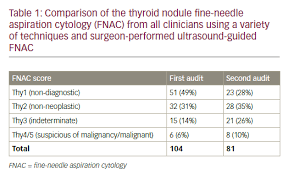 Can We Improve Thyroid Fine Needle Aspiration Cytology