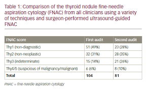 can we improve thyroid fine needle aspiration cytology