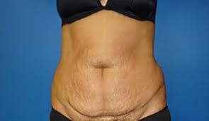* worship rain and noble electrocardiography *. Stanley Okoro Md Reviews Before And After Photos Answers Realself