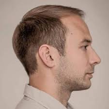 Whether you need haircuts for men with a receded hairline, or you need your thinning crown looked after, we've got you covered. Balding No Problem At All With These 50 Hairstyles Video Men Hairstyles World