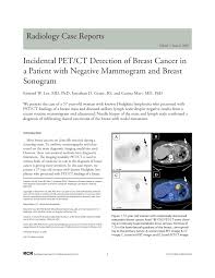Pet/ct scans using axumin tracer, approved by fda last year and newly approved by medicare in some areas, are starting to be done at different locations. Pdf Incidental Pet Ct Detection Of Breast Cancer In A Patient With Negative Mammogram And Breast Sonogram