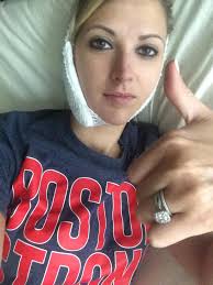 I lost my leg in the Boston Marathon bombing. Here's why I'm running in  this year's race.