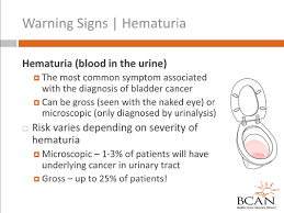 Patients with urinary incontinence suffer urine leakages or dribbling of urine in the most unexpected moments or a sudden urge to urinate that is impossible to hold back. Https Bcan Org Wp Content Uploads 2018 06 Risks Part Ii Pdf