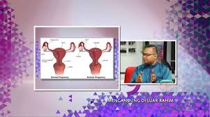Daku sendiri saat berada di dalam ward untuk bersalin dulu. Nyawa Ibu Terancam Risiko Kandungan Pecah Hamil Luar Rahim Jangan Cuba Cuba Urut Pa Ma