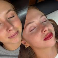 Lips before and after from @roseandbladetattoo ! To scheduled your next PMU  session with Rose, head over to our website to book!  Honorandgracetattoo.com or roseandbladetattoo.com! #permanentmakeup  #browtattoo #liptattoo #freckletattoo #rosedillon ...